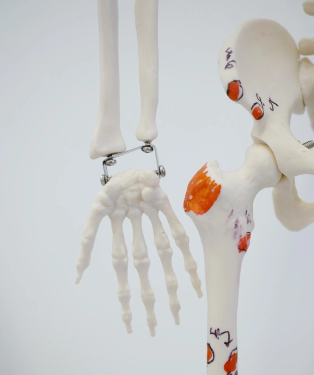 фото проведения денситометрии